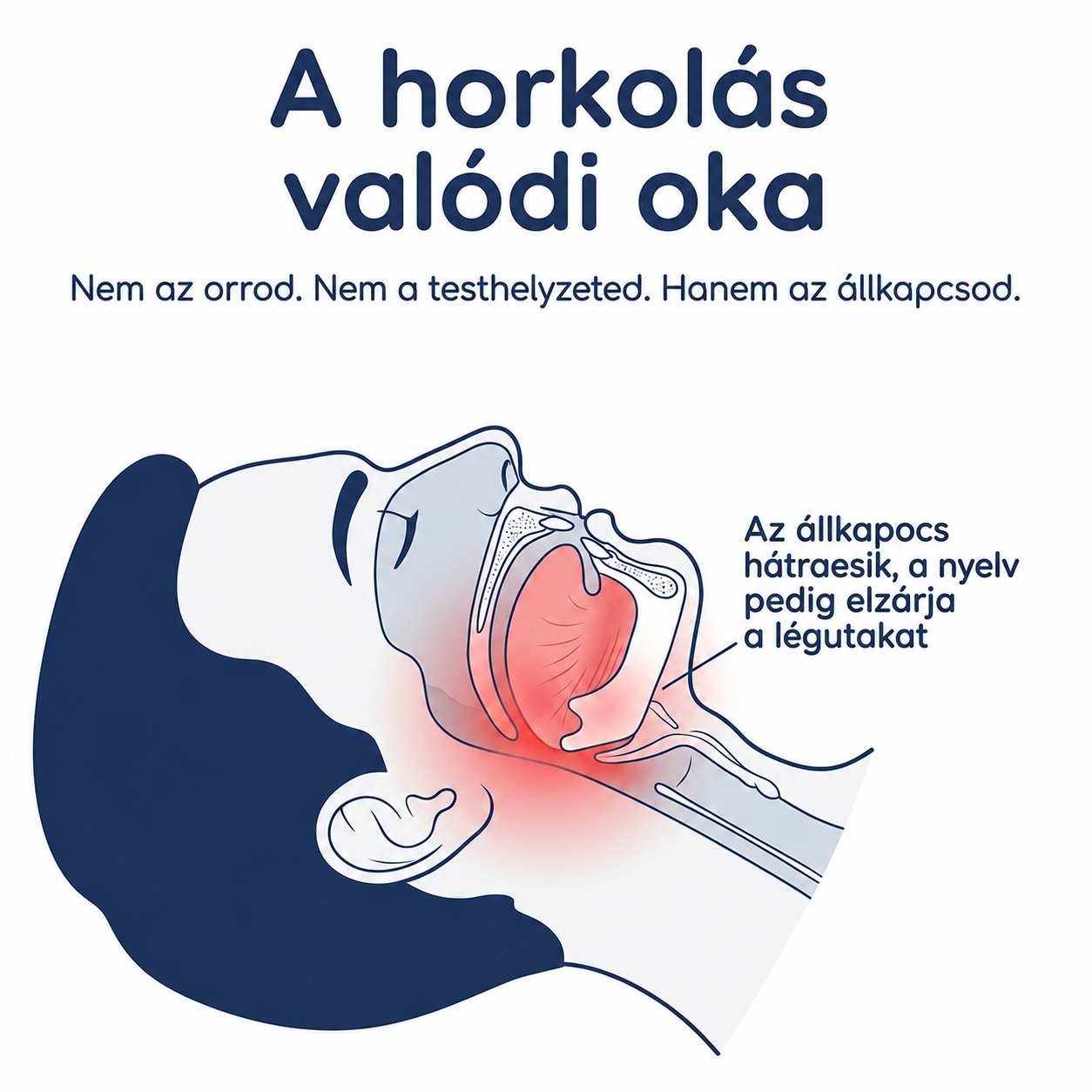 „Szüntesd meg a horkolást már az első éjszakától – SomnoLab (+ AJÁNDÉK TOK)