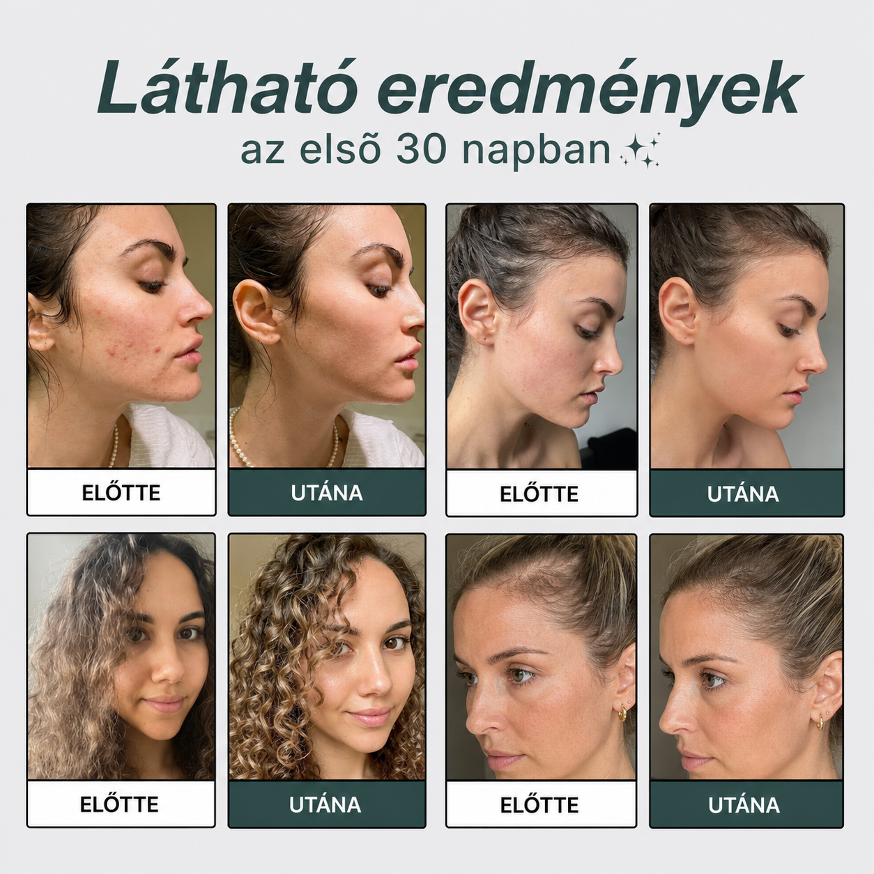 Mentsd meg a bőröd, a hajad és az egészséged a katasztrófától az AquaVita Oasis™-szal! (+1 extra szűrő ajándékba ma)