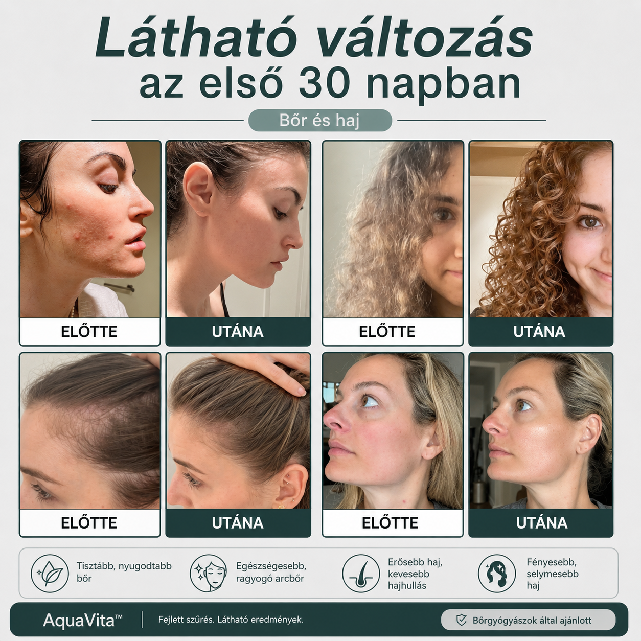 1+1 INGYEN l Védd meg bőröd és hajad a kemény víz káros hatásaitól az AquaVita™ segítségével